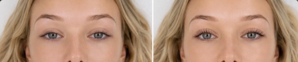 Wimpernlifting Vorher Nachher